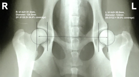 OFA x-ray_Duke-PercentCoverage.jpg